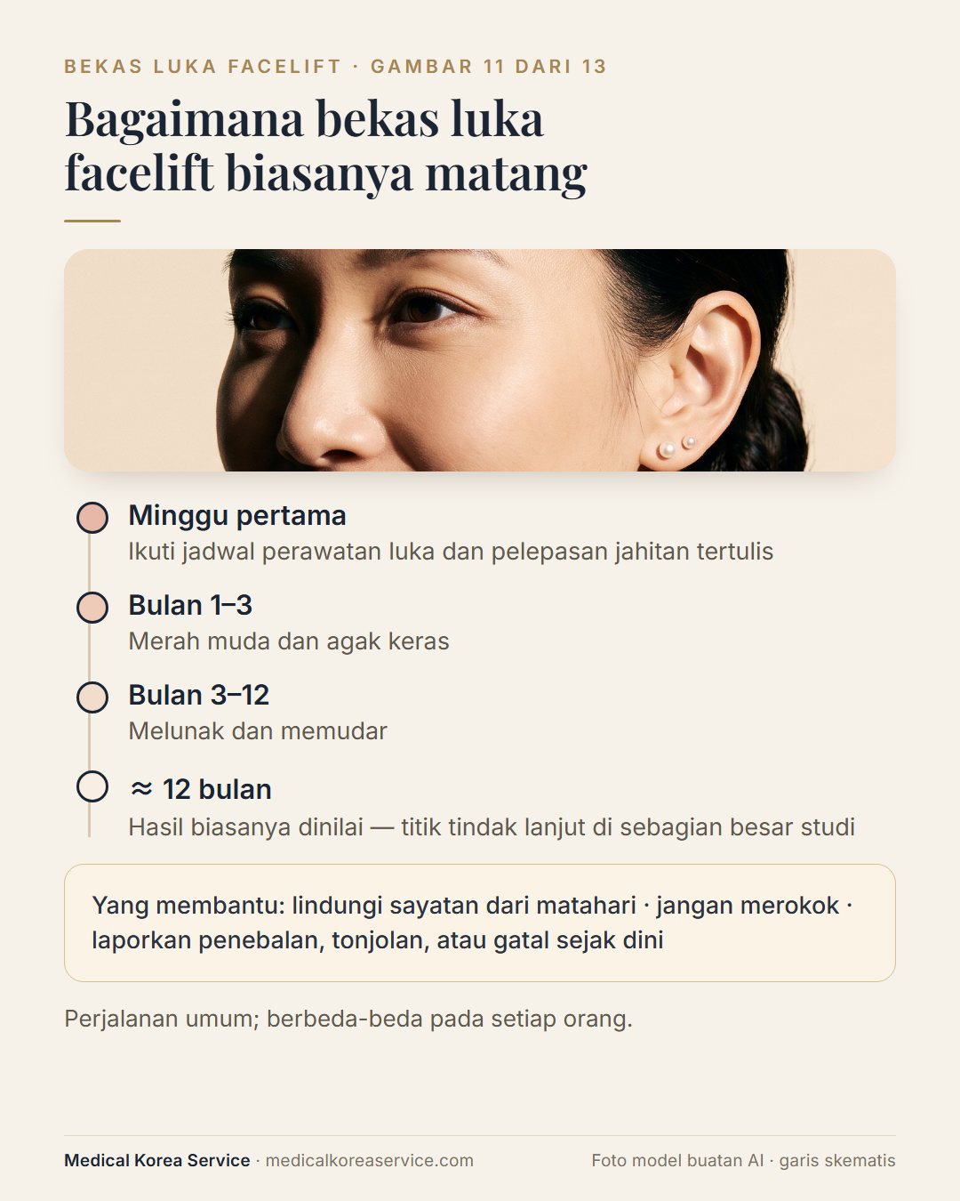 Foto model buatan AI. Garis waktu pematangan bekas luka facelift dari minggu pertama hingga sekitar 12 bulan: merah muda dan keras, lalu melunak dan memudar