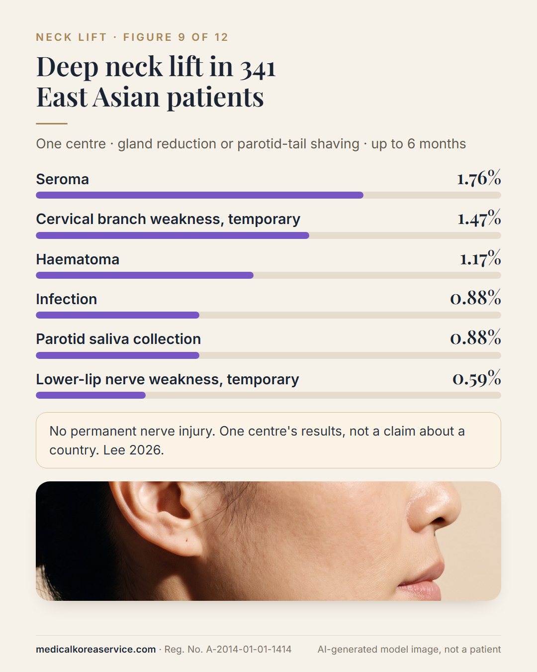 AI-generated model photo. Bar chart of complications in 341 East Asian deep neck lift patients: seroma 1.76%, cervical branch weakness 1.47%, haematoma 1.17%, infection 0.88%, parotid saliva collection 0.88%, lower-lip nerve weakness 0.59%
