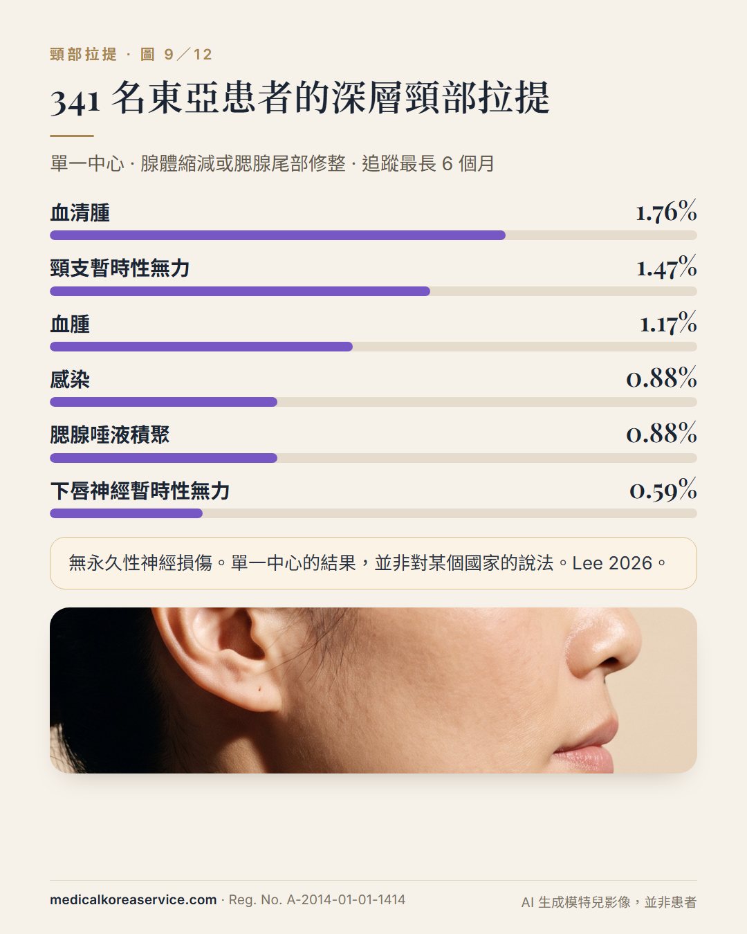 AI 生成的模特兒照片。341 名東亞深層頸部拉提患者的併發症長條圖:血清腫 1.76%、頸支無力 1.47%、血腫 1.17%、感染 0.88%、腮腺唾液積聚 0.88%、下唇神經無力 0.59%