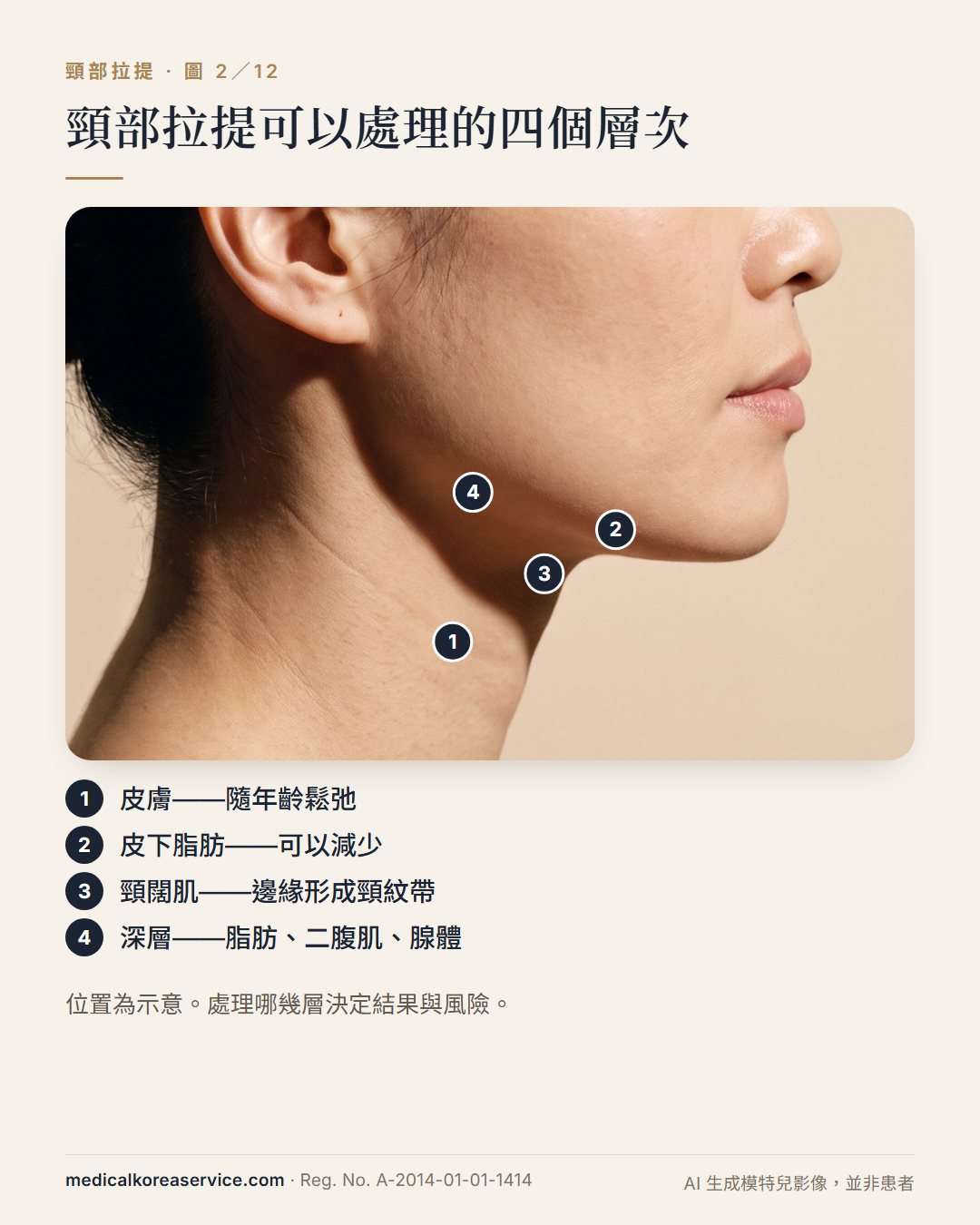 AI 生成的模特兒照片。女性側面照,頸部標示四個編號:皮膚、皮下脂肪、頸闊肌,以及含二腹肌與下頜下腺的深層