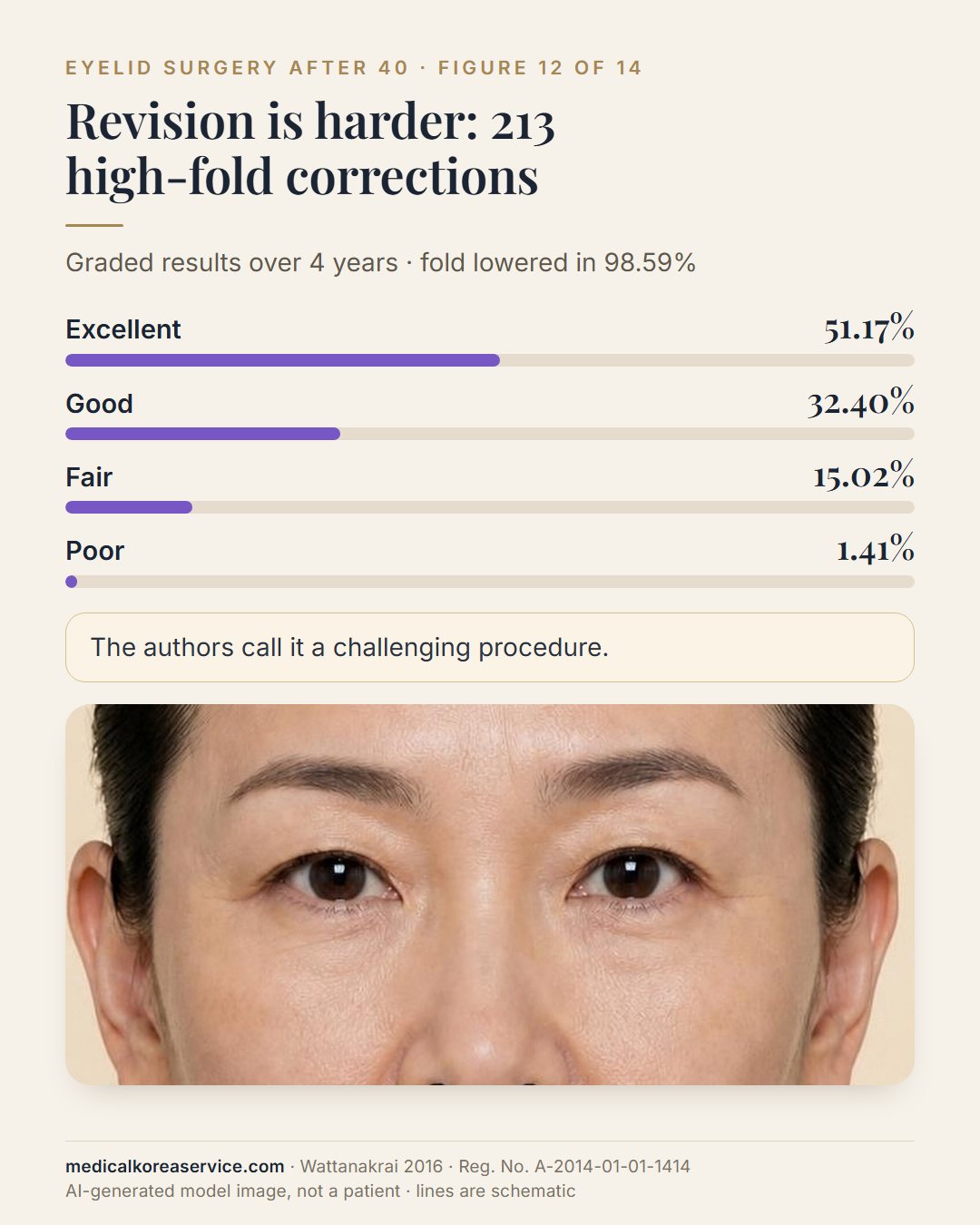 AI-generated model photo. Bar chart of graded results in 213 revision operations for a high eyelid fold beside a portrait: excellent 51.17%, good 32.40%, fair 15.02%, poor 1.41%