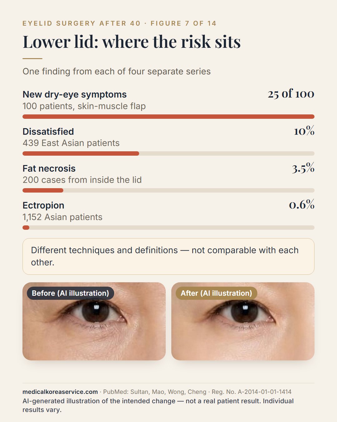AI-generated model photo. Bar chart of lower blepharoplasty findings above a before-and-after pair of the eye: new dry-eye symptoms in 25 of 100 patients, 10% dissatisfied of 439, fat necrosis 3.5% of 200 cases, ectropion 0.6% of 1,152 The before and after images are an AI-generated illustration of the intended change, not a real patient result.