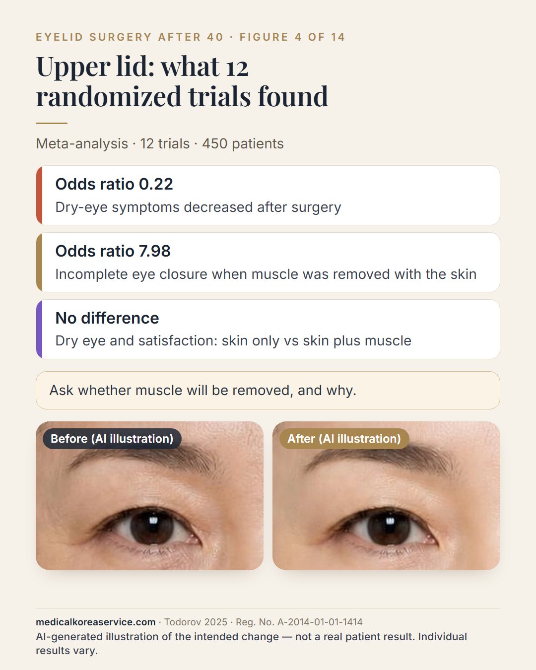 AI-generated model photo. Three findings from 12 randomized trials of upper blepharoplasty in 450 patients above a before-and-after pair of the eye: dry-eye odds ratio 0.22, incomplete eye closure odds ratio 7.98 with muscle removal, no difference in satisfaction The before and after images are an AI-generated illustration of the intended change, not a real patient result.