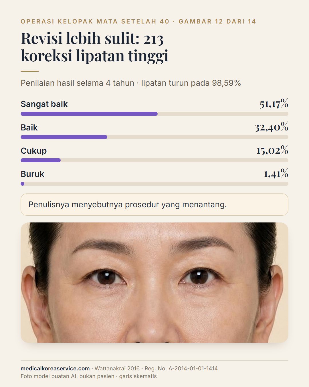 Foto model buatan AI. Diagram batang penilaian hasil 213 operasi revisi lipatan kelopak yang terlalu tinggi di samping potret: sangat baik 51,17%, baik 32,40%, cukup 15,02%, buruk 1,41%