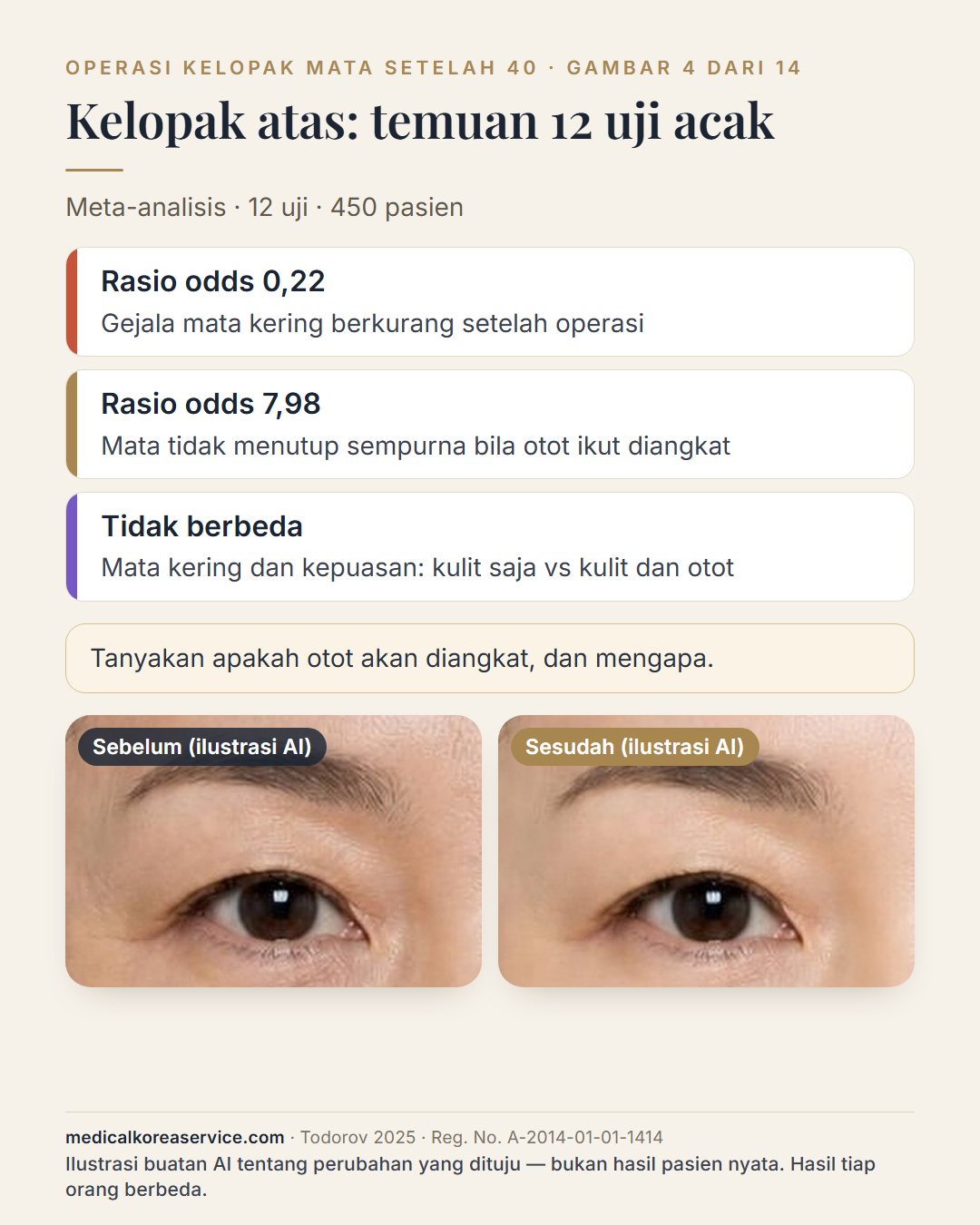 Foto model buatan AI. Tiga temuan dari 12 uji acak blefaroplasti atas pada 450 pasien di atas sepasang gambar mata sebelum dan sesudah: rasio odds mata kering 0,22, rasio odds mata tidak menutup sempurna 7,98 bila otot diangkat, kepuasan tidak berbeda Gambar sebelum dan sesudah adalah ilustrasi buatan AI tentang perubahan yang dituju, bukan hasil pasien nyata.