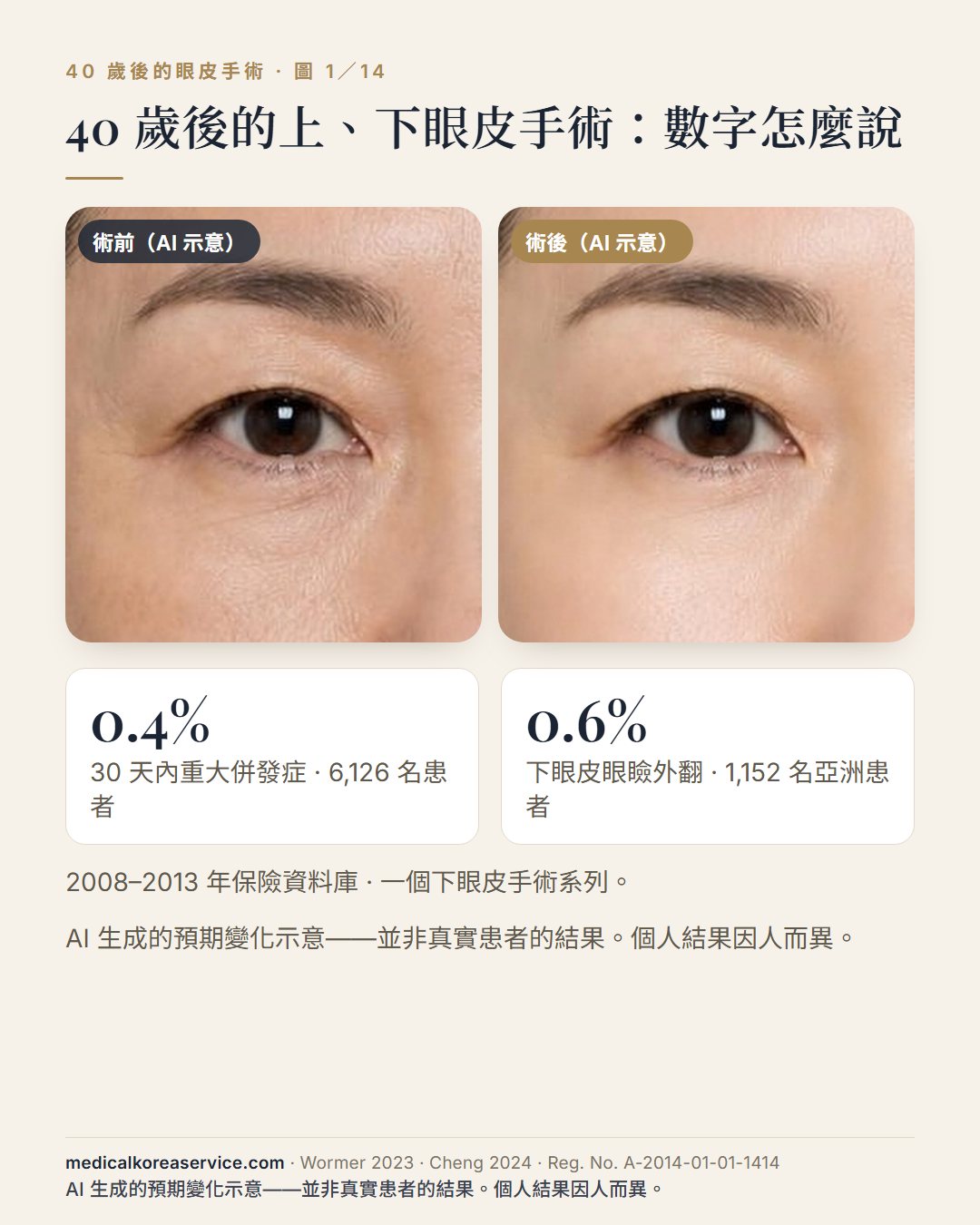 AI 生成的模特兒照片。四十多歲女性單眼的術前與術後示意圖與兩個數字：6,126 名眼皮與提眉患者 30 天內重大併發症 0.4%；1,152 名亞洲患者下眼皮眼瞼外翻 0.6%術前與術後影像為 AI 生成的預期變化示意，並非真實患者的結果。