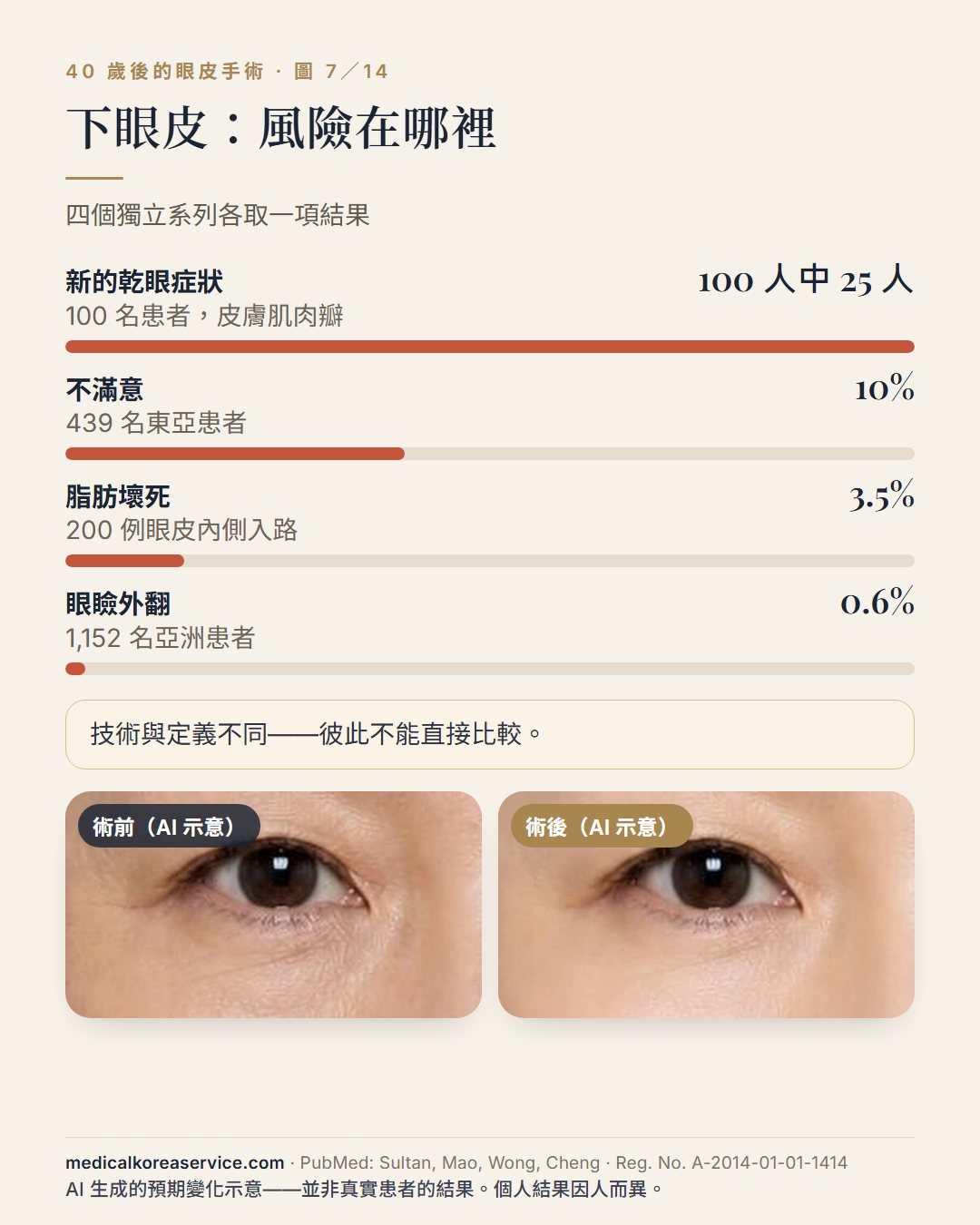 AI 生成的模特兒照片。眼睛術前與術後示意圖上方的下眼皮成形術長條圖：100 人中 25 人出現新的乾眼症狀、439 人中 10% 不滿意、200 例中脂肪壞死 3.5%、1,152 人中眼瞼外翻 0.6%術前與術後影像為 AI 生成的預期變化示意，並非真實患者的結果。