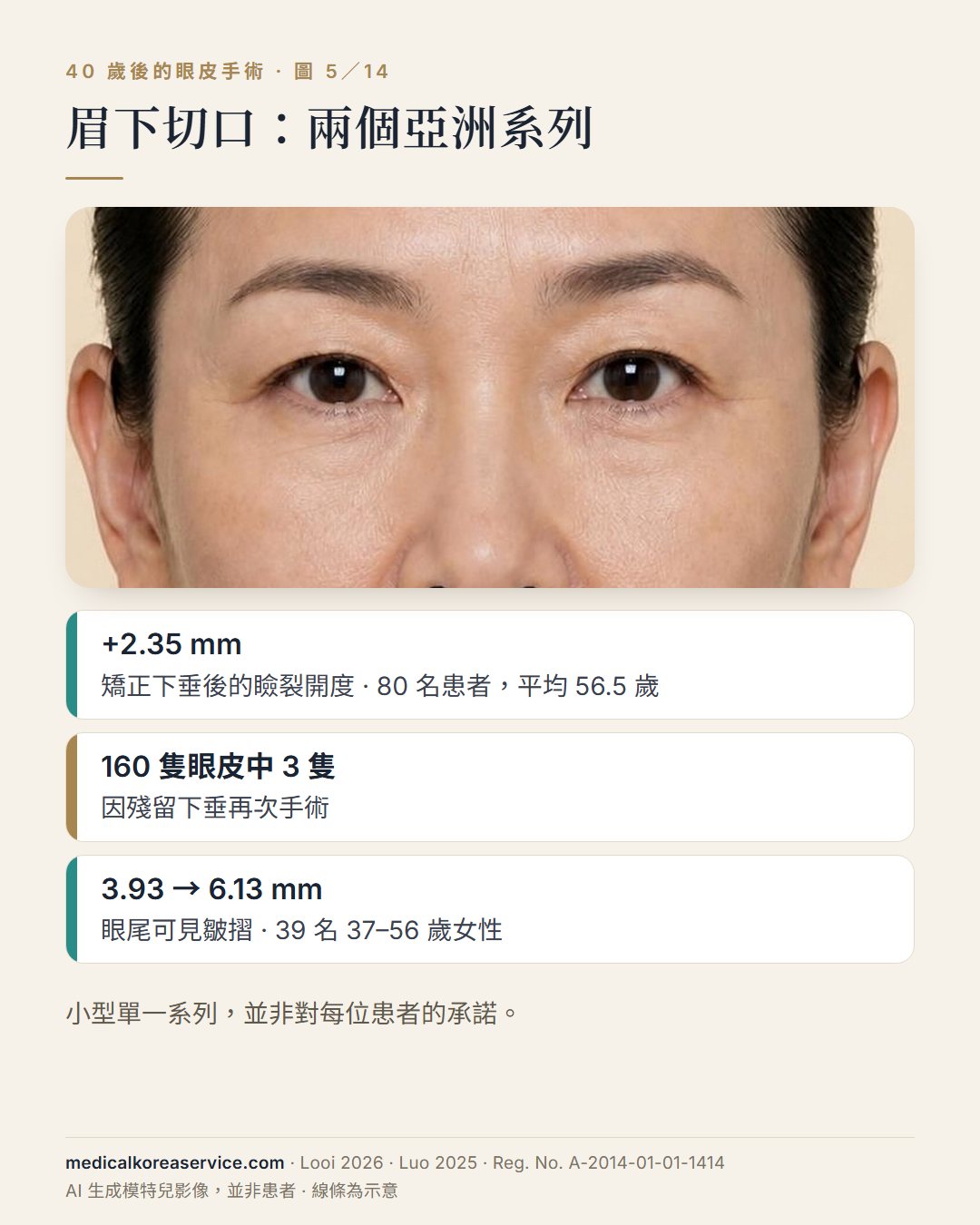 AI 生成的模特兒照片。肖像旁列出亞洲患者眉下切口手術的三項結果：80 名患者瞼裂開度增加 2.35 mm、160 隻眼皮中 3 隻再次手術、39 名女性眼尾皺摺由 3.93 增至 6.13 mm