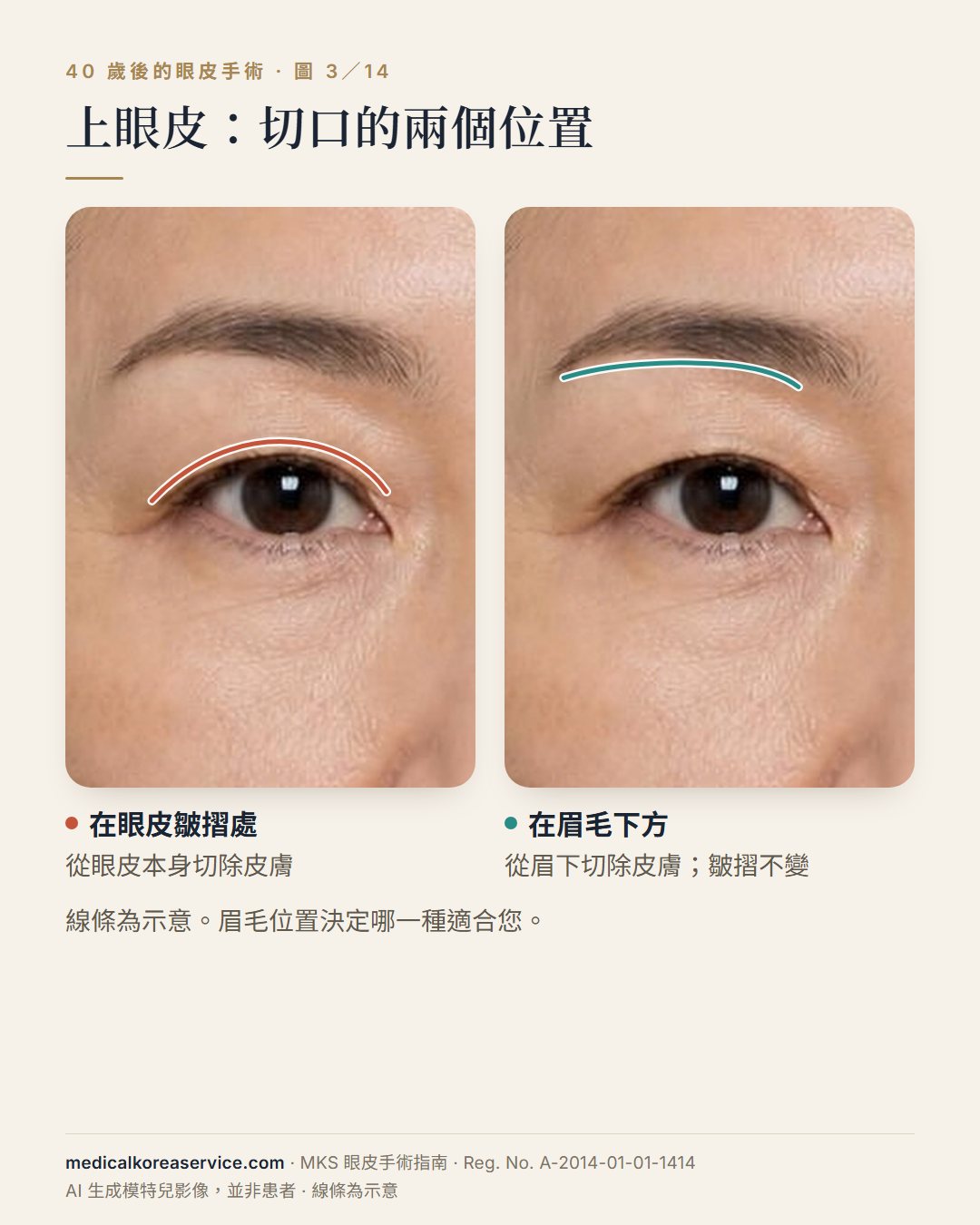 AI 生成的模特兒照片。同一隻眼睛的兩張圖，比較上眼皮切口位置：一條線在眼皮皺摺處，一條線在眉毛正下方