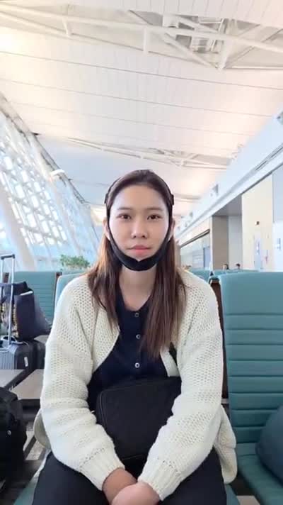 Desi Finata, Chinese-Indonesian patient — Mini Facelift in Korea, video review